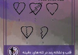 قلب و نشانه رعد در تله های گنج و دفینه